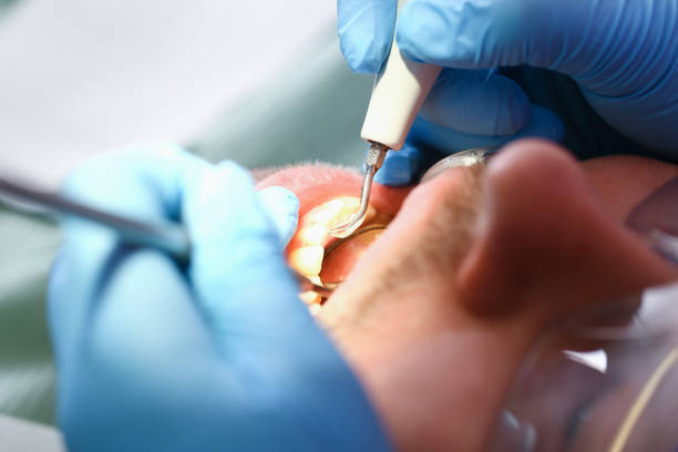 Best Emergency Gum Pain Relief  in Tomball, TX